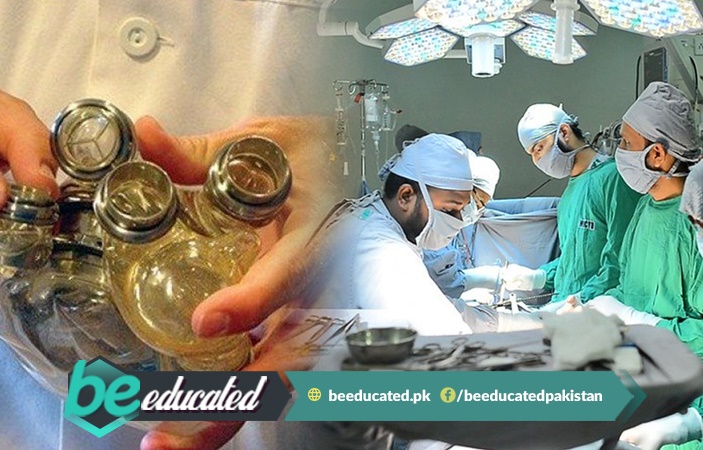 Pakistans First Mechanical Heart Patient Is On Her Feet