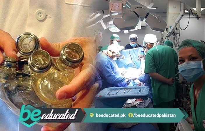 Pakistans First Mechanical Heart Pump Implantation 